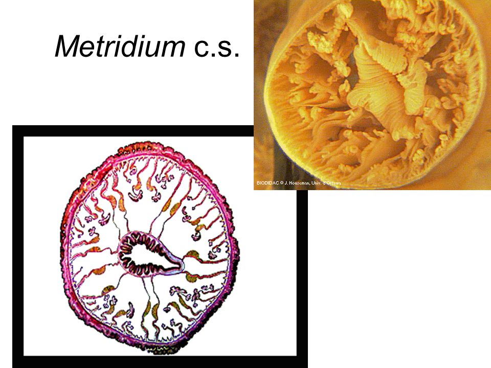 Metridium c.s.