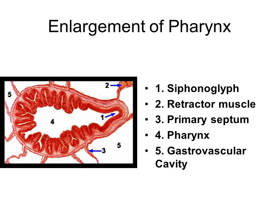 Enlargement of Pharynx