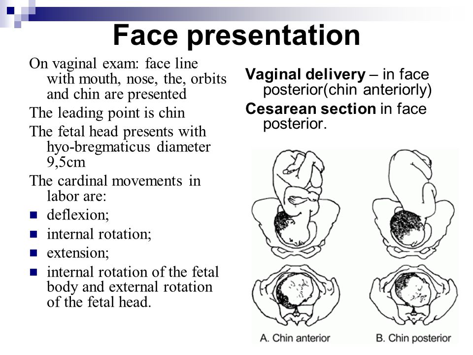 Face presentation On vaginal exam: face line with mouth, nose, the, orbits ...