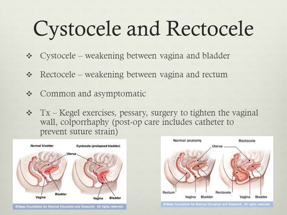 Pdf Vaginal Candidiasis Gynecological Aspect Of The Problem