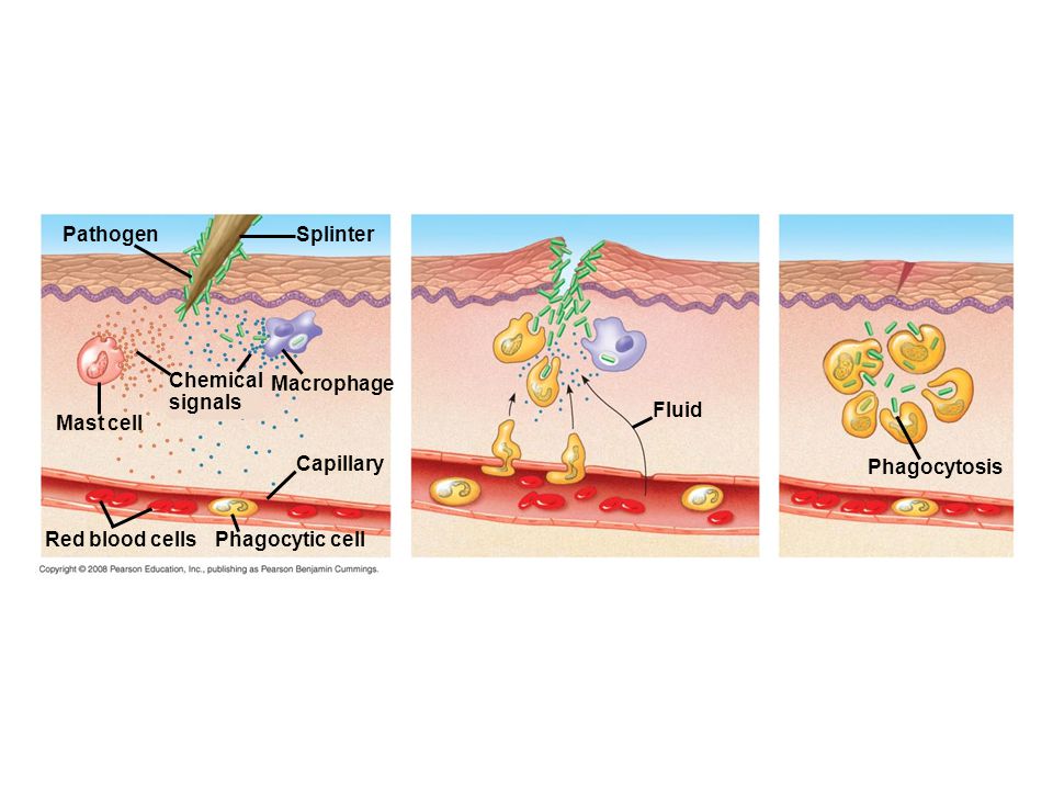 Pathogen Splinter Chemical signals Macrophage Fluid Mast cell