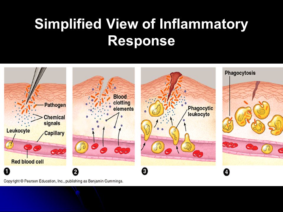 Simplified View of Inflammatory Response