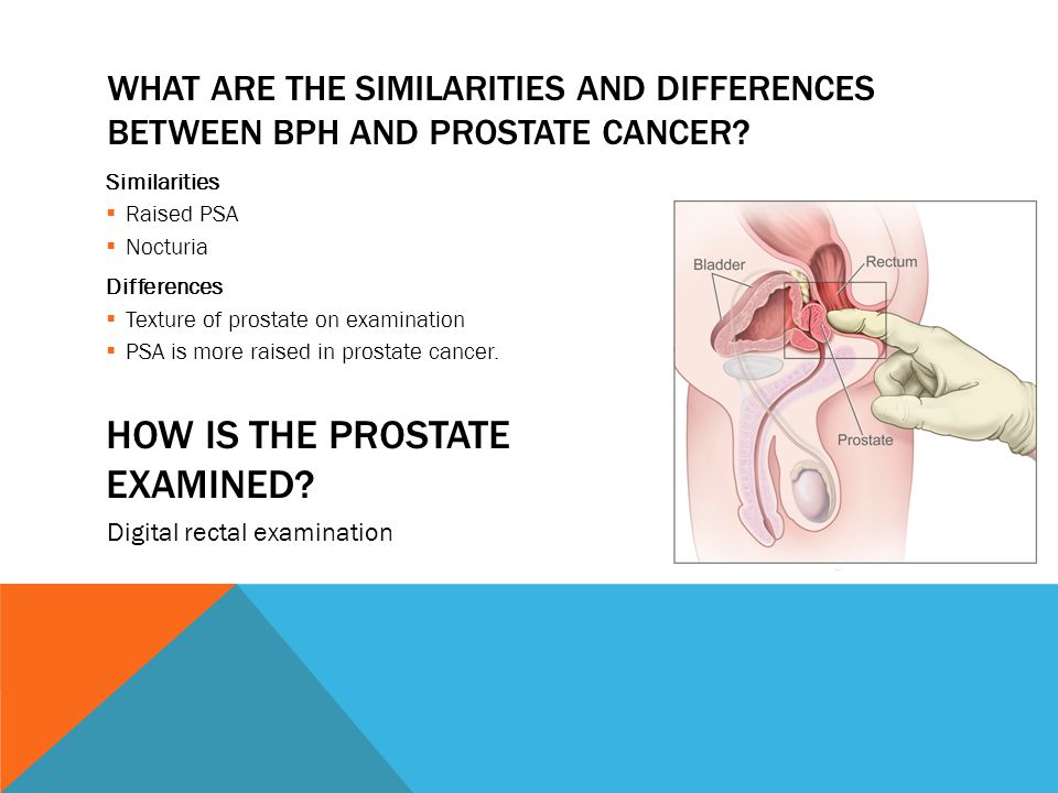 prostatitis a férfiakban a következmények jelei cele mai bune medicamente pentru prostata