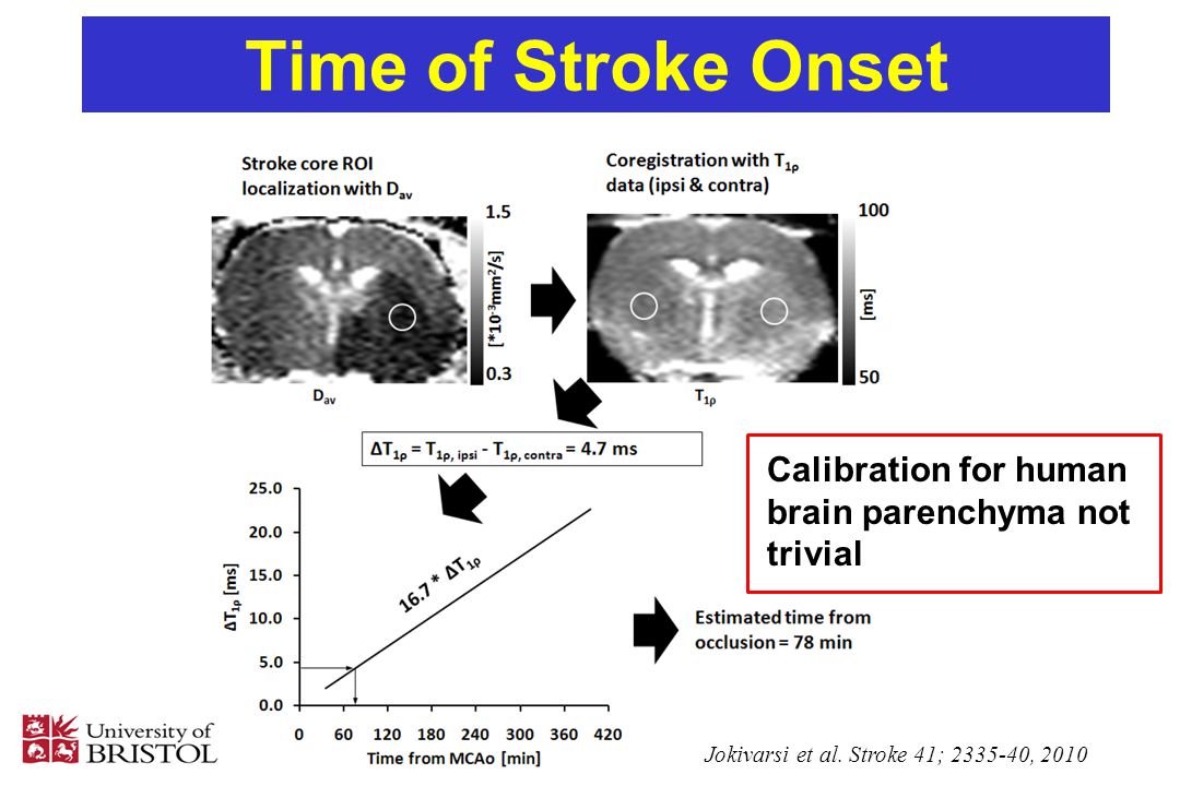 Time of Stroke Onset 2 days later remote controlled gradual occluder
