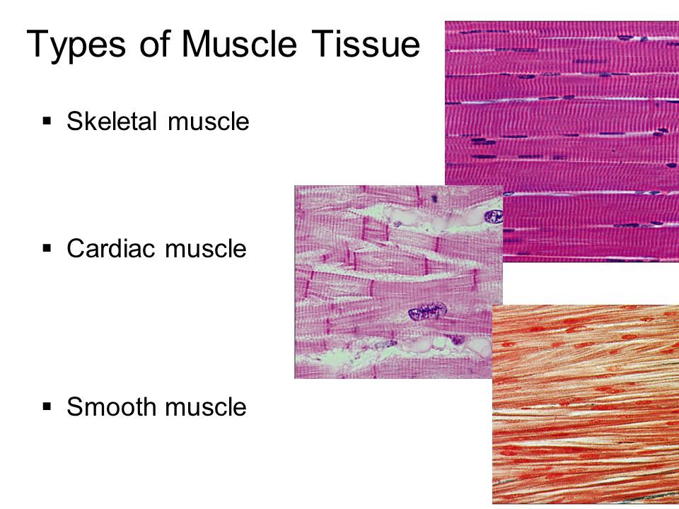 Muscle Histology Ppt Download