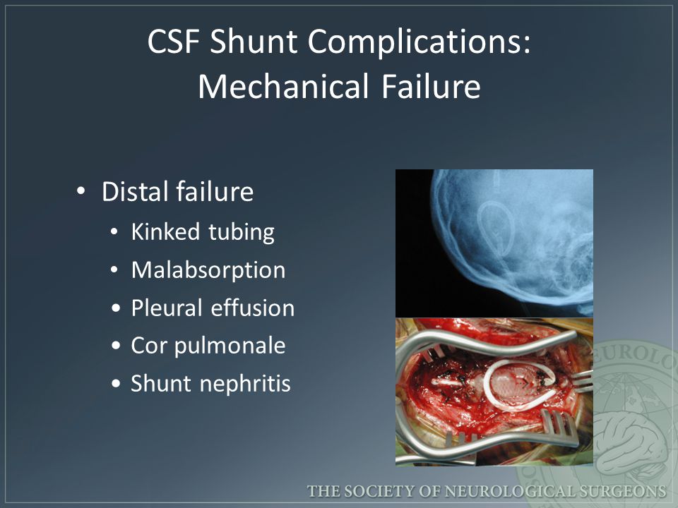 Mechanical Shunt Complications