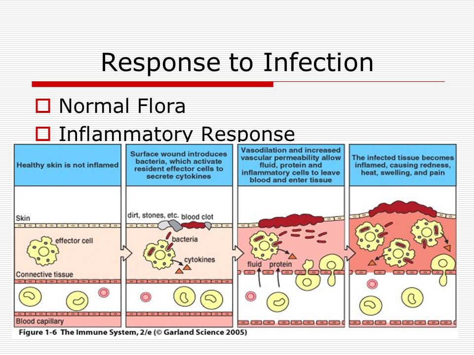 Inflammatory Response. 