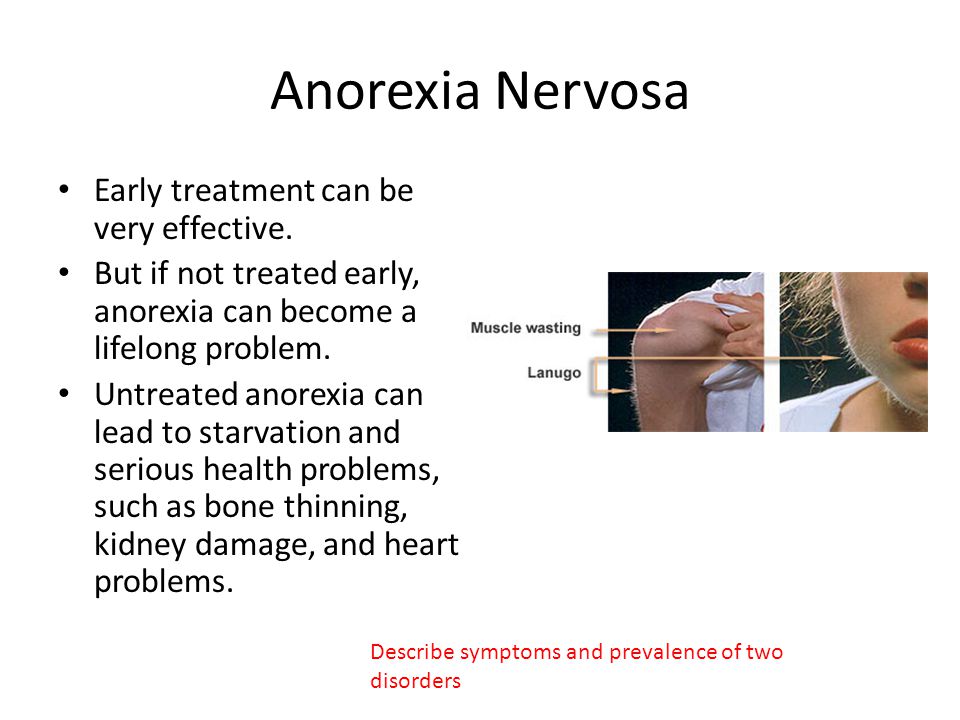 Anorexia Nervosa Early treatment can be very effective.