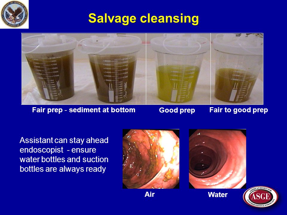 Water-aided Colonoscopy: water immersion & water exchange - ppt video  online download