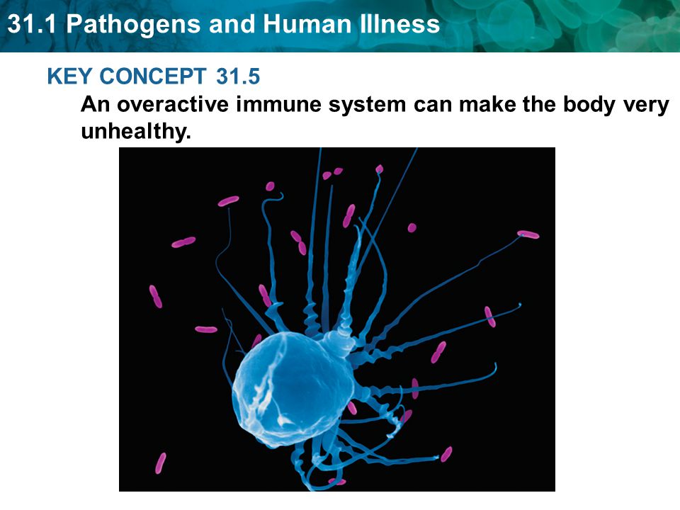 KEY CONCEPT 31.5 An overactive immune system can make the body very unhealthy.