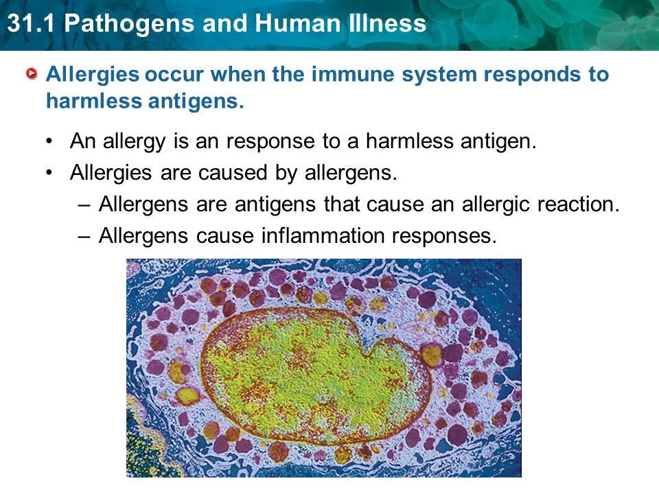 Allergies occur when the immune system responds to harmless antigens.