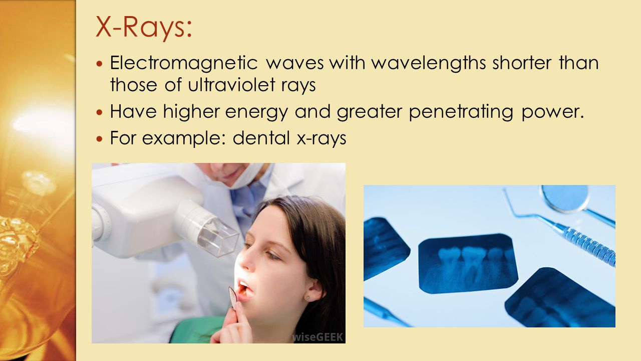 X-Rays: Electromagnetic waves with wavelengths shorter than those of ultraviolet rays. Have higher energy and greater penetrating power.