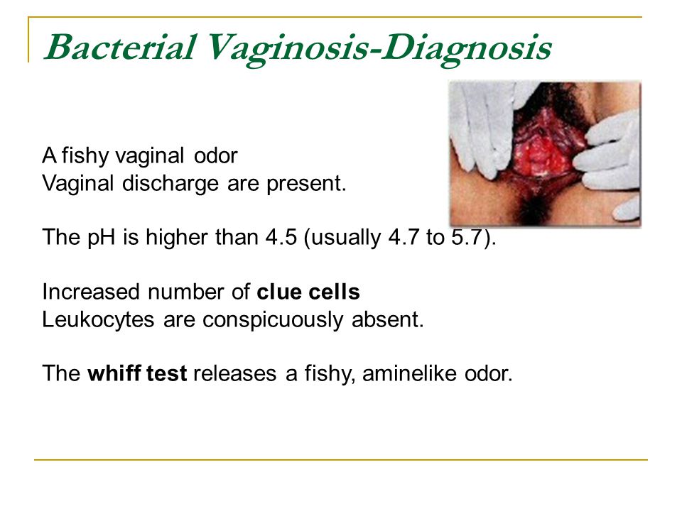 Diagnosing Vaginal Infections