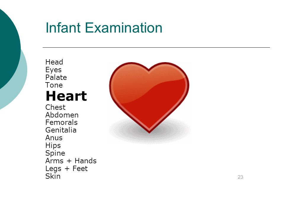 Infant Examination Heart Head Eyes Palate Tone Chest Abdomen Femorals