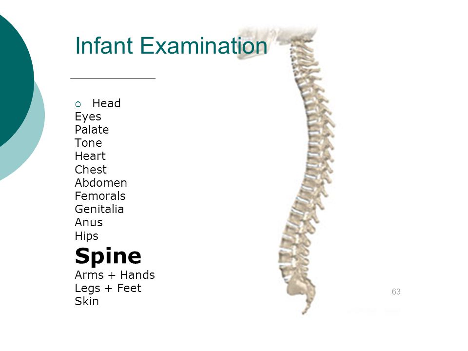 Infant Examination Spine Head Eyes Palate Tone Heart Chest Abdomen