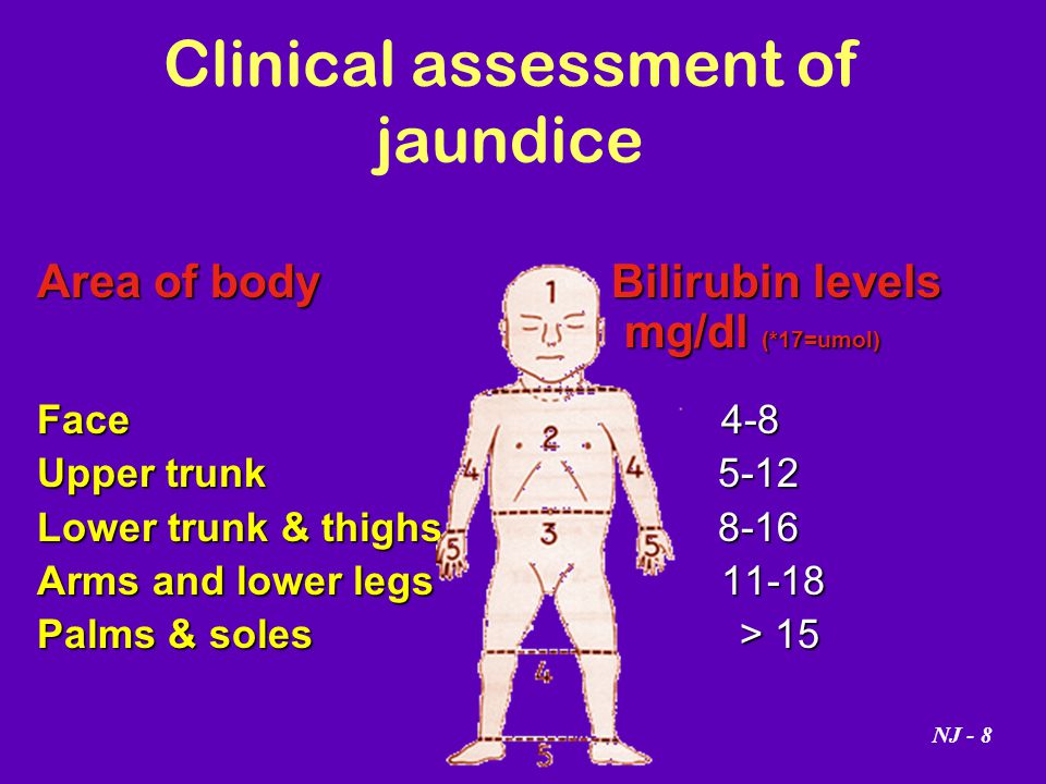Neonatal Jaundice Bilirubin Levels Chart