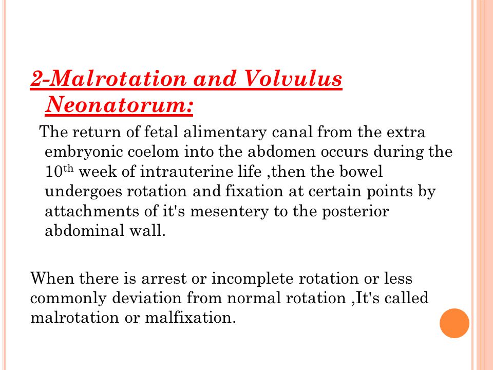 2-Malrotation and Volvulus Neonatorum: