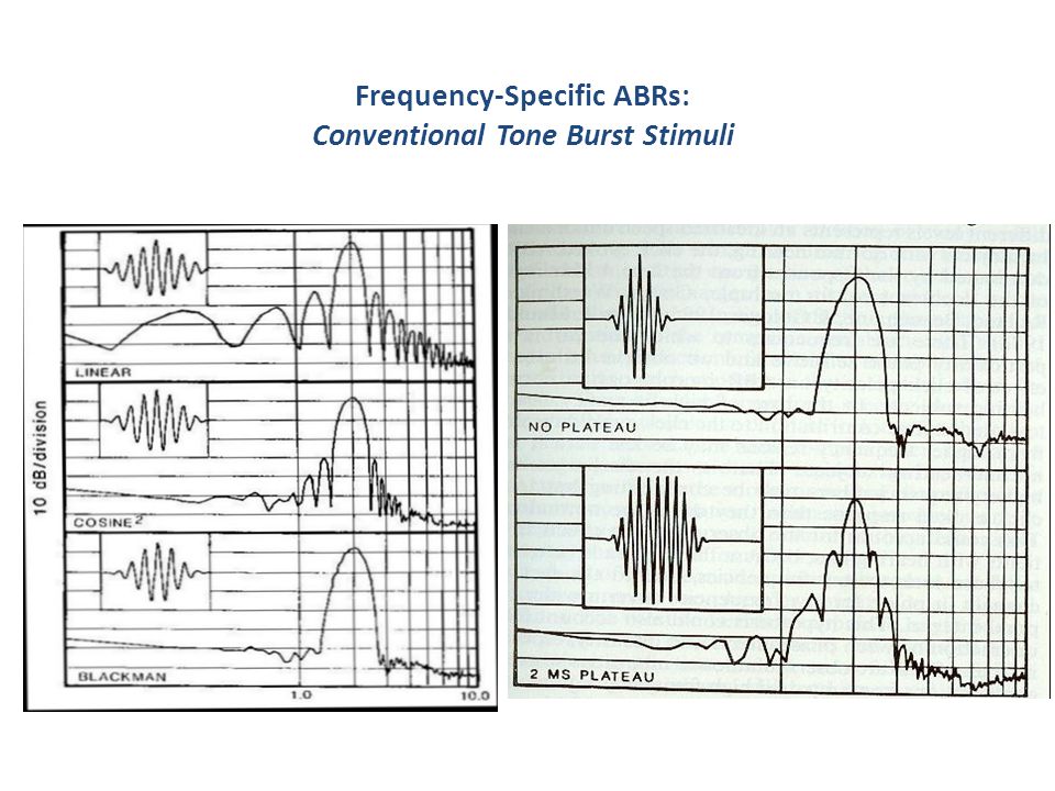 of Click-Evoked ABR: Lack of Frequency-Specificity - ppt video online download