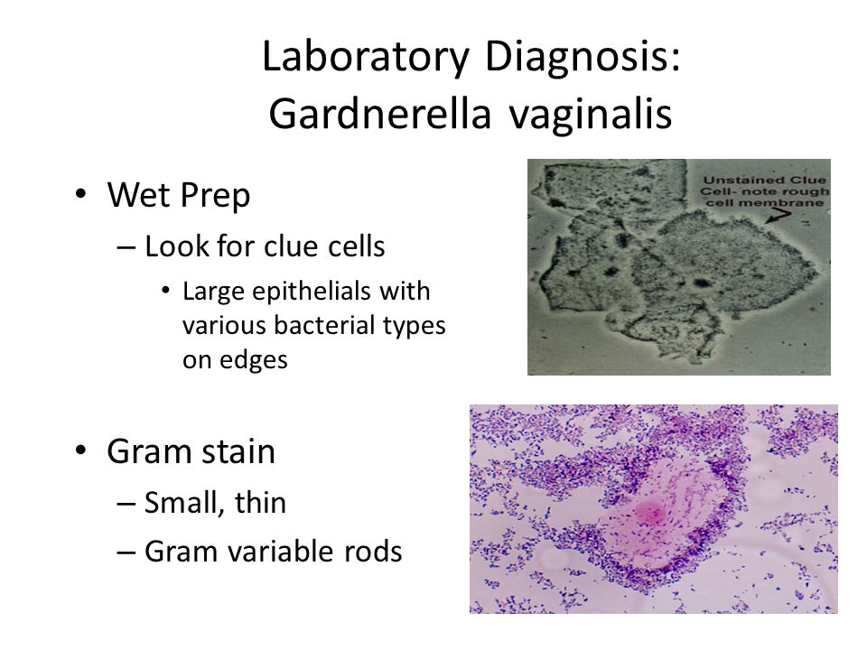 Gardnerella vaginalis факторы вирулентности. Гарднерелла и нейссерия. Гарднелла вагиналис в Кале.