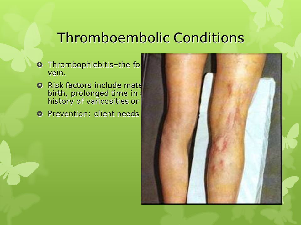 Thromboembolic Conditions
