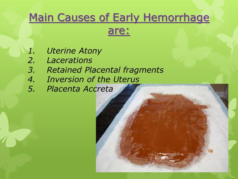 Main Causes of Early Hemorrhage are: