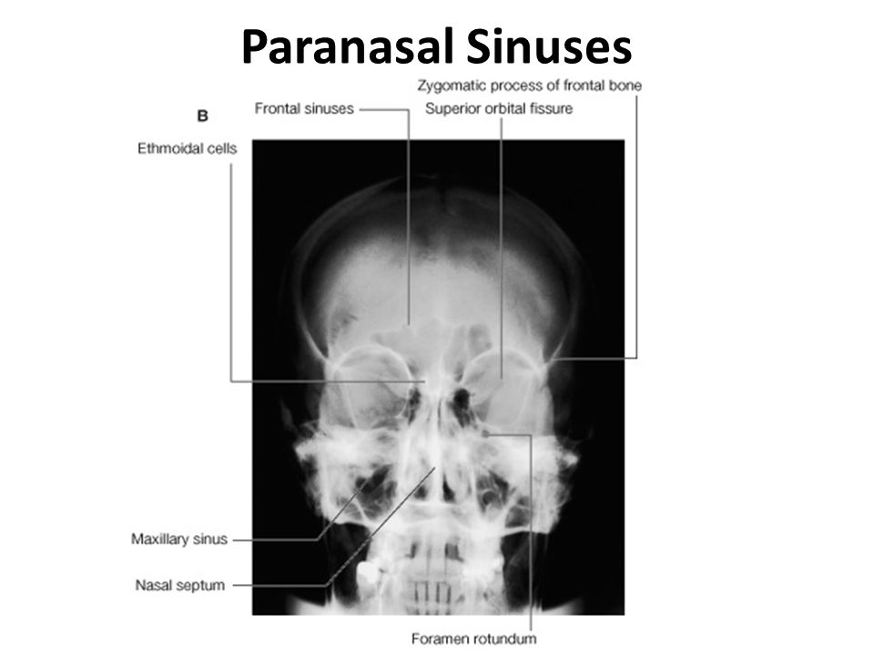 parts pharynx of Cavity & online download ppt sinuses video Paranasal   Nasal