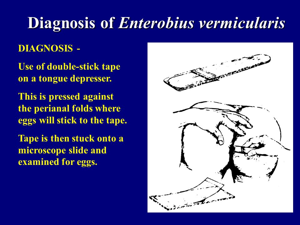 diagnosis of enterobiasis)