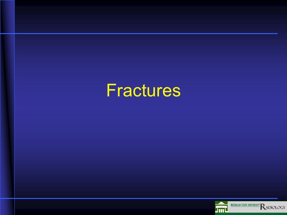 Fractures In this unit we will be discussing fractures. - ppt video ...