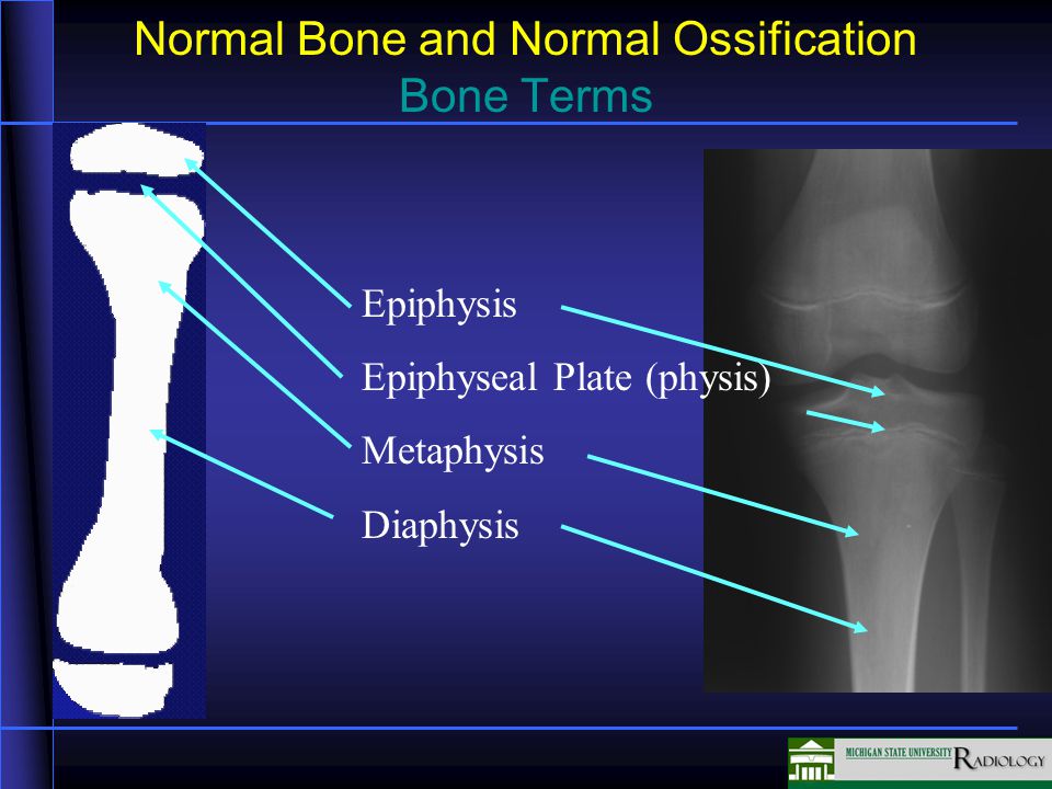 Fractures In this unit we will be discussing fractures. - ppt video