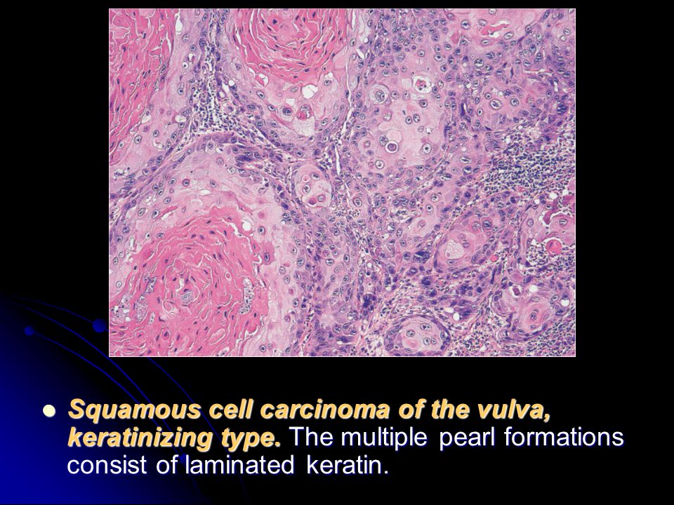 Pathology outlines