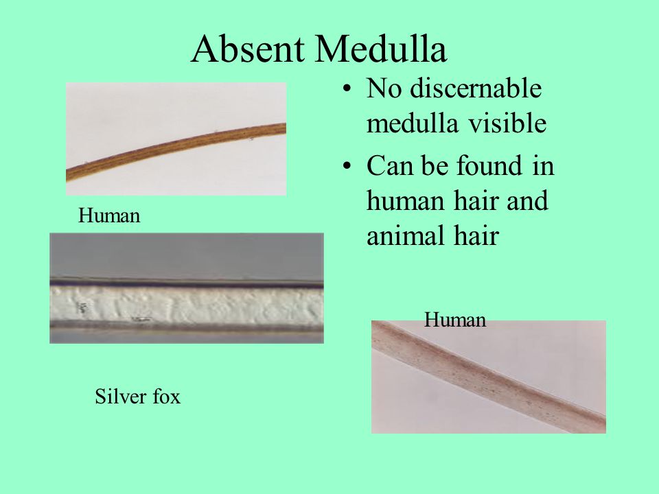 CHAPTER 10 HAIR AND FIBER. - ppt video online download CHAPTER 10 HAIR AND FIBER. - ppt video online download