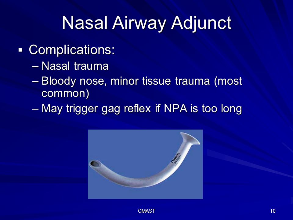 If a Nasopharyngeal Airway Is Too Long It May