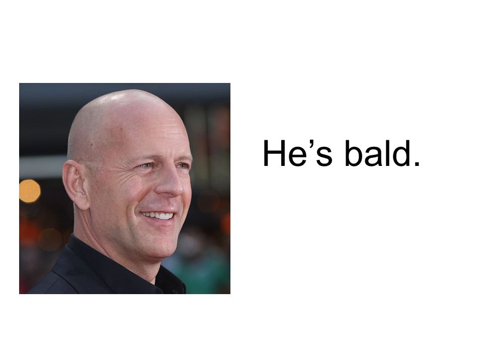 He’s bald.