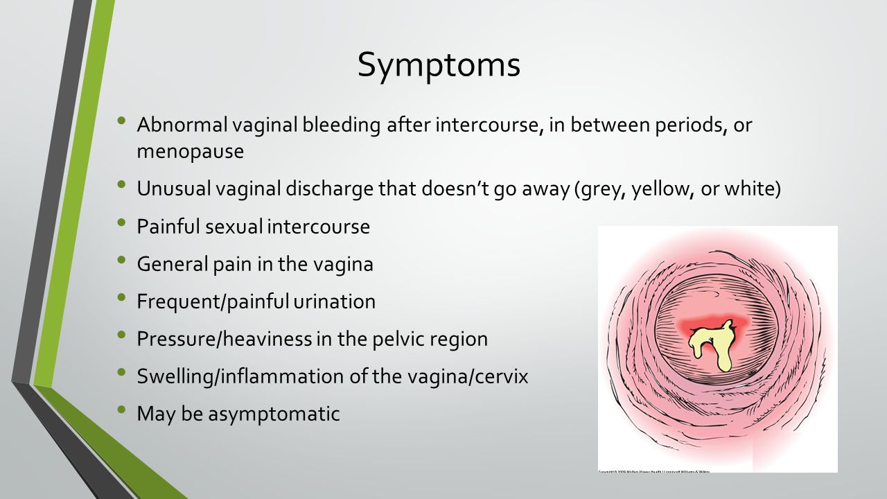 Why Bleeding Or Spotting Occurs Between Periods