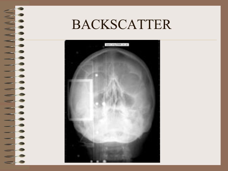 RADIOGRAPHIC ARTIFACTS - ppt video online download