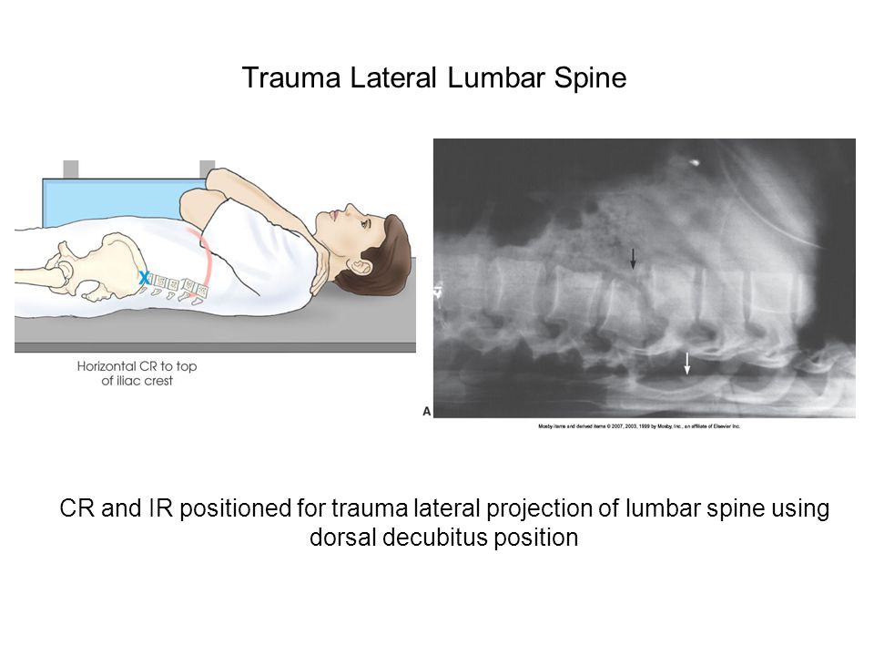trauma radiography positioning