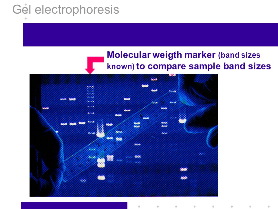 Gel electrophoresis Molecular weigth marker (band sizes known) to compare sample band sizes