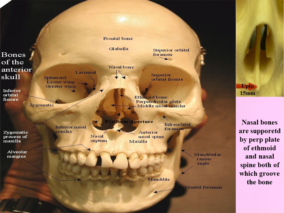 Большие лобные кости. Лобная кость черепа человека. Лобная кость отростки. Глазничная пластинка лобной кости. Лобная кость Синельников.