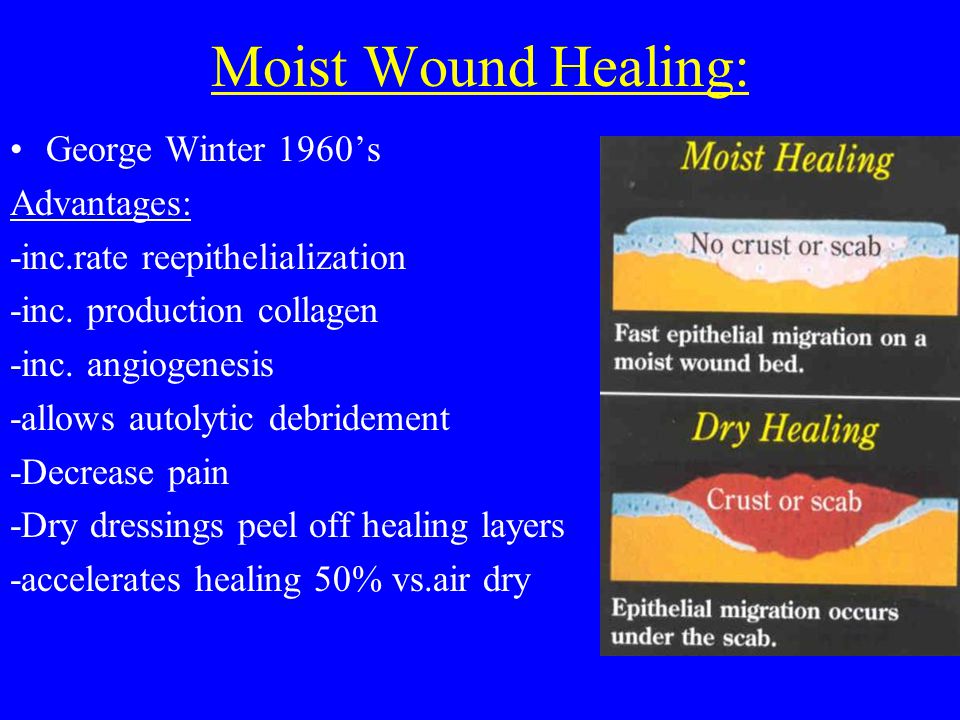 CURRENT CONCEPTS IN WOUND CARE - ppt video online download