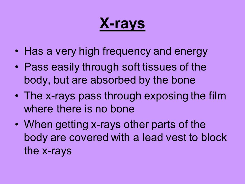 X-rays Has a very high frequency and energy