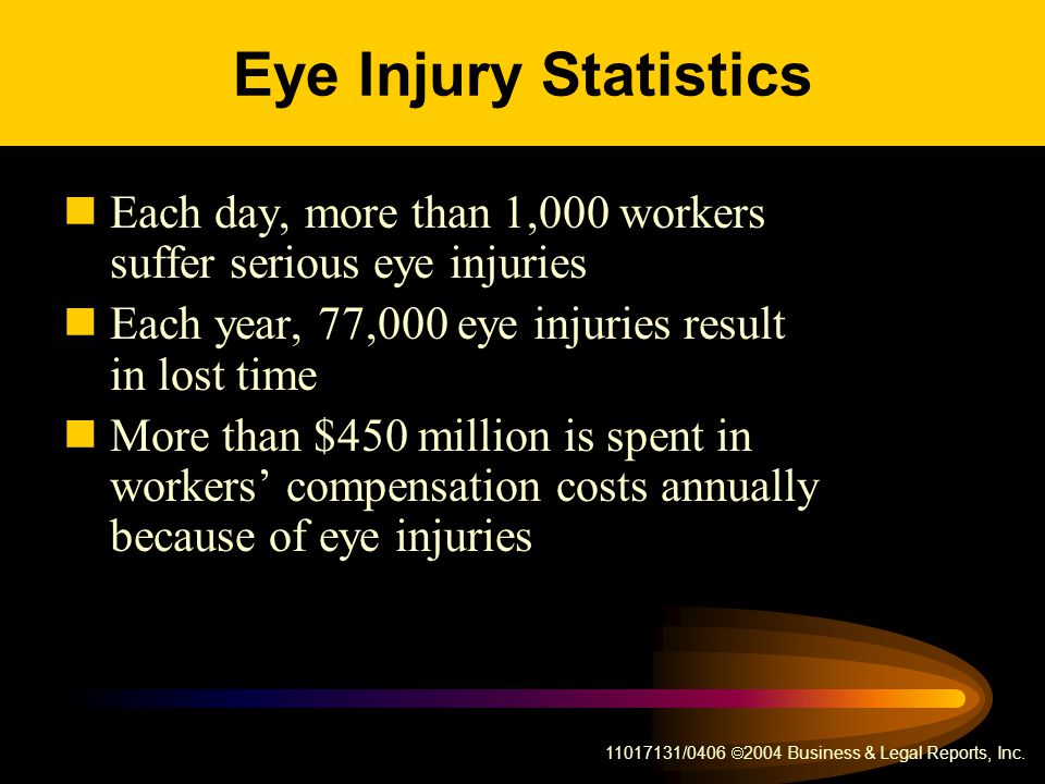 Eye Injury Statistics Each day, more than 1,000 workers suffer serious eye injuries. Each year, 77,000 eye injuries result in lost time.