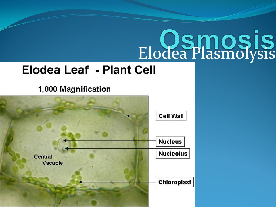 Особенности внутреннего строения элодеи. Элодея под микроскопом строение. Клетки элодеи под микроскопом плазмолиз. Строение Elodea. Внутреннее строение клетки элодеи.