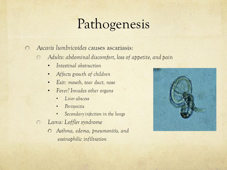 aszcariasis patogenezis