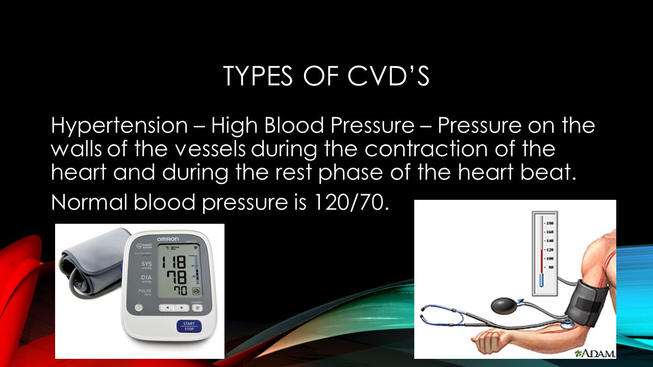 Types of CVD’s
