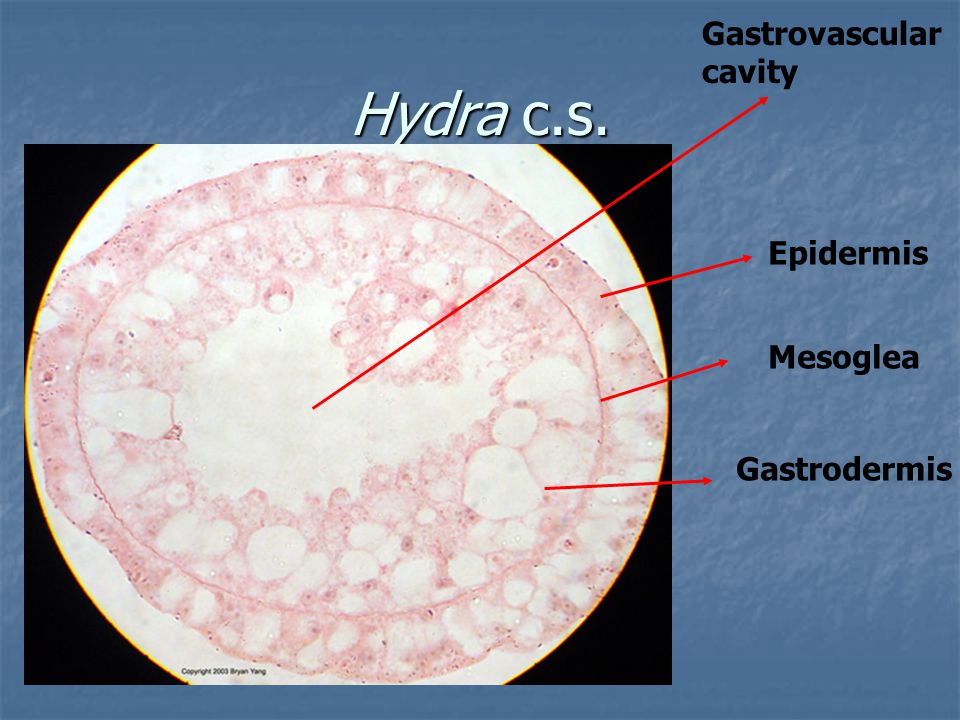Gastrovascular cavity Hydra c.s. Epidermis Mesoglea Gastrodermis