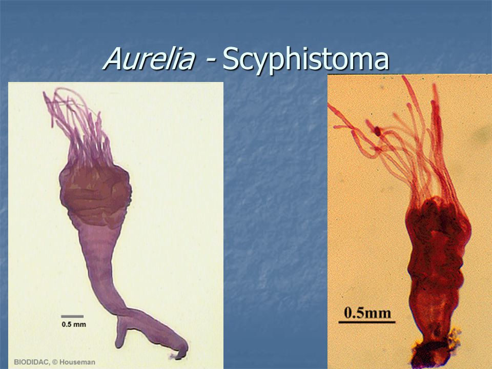 Aurelia - Scyphistoma