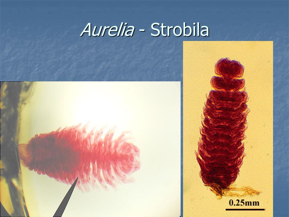 Aurelia - Strobila