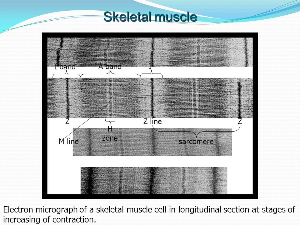 Skeletal muscle I band. A band. I. Z. Z line. Z. H zone. M line. sarcomere.