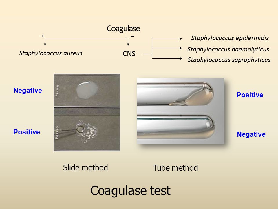 How to identify Staphylococcus aureus using the Coagulase Test - Slide and Tube Method - 4K