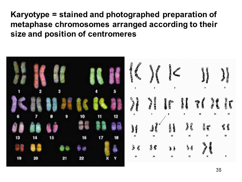 Karyotype = stained and photographed preparation of metaphase chromosomes arranged according to their size and position of centromeres